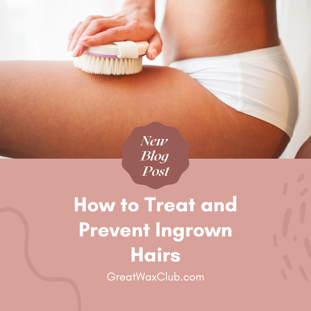 How to Treat and Prevent Ingrown Hairs